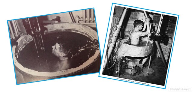 Early Ultrasound Machines