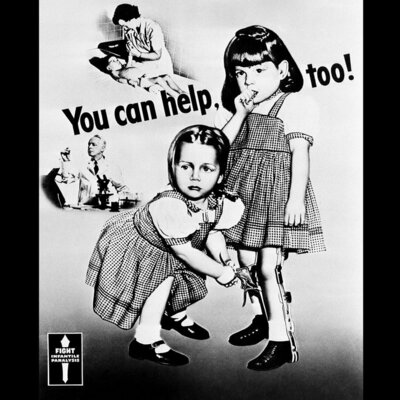 Timeline: Polio, From Head to Toe!