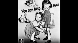 Timeline: Polio, From Head to Toe!