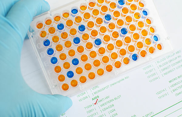Development of ELISA test to screen for diseases such as HIV.