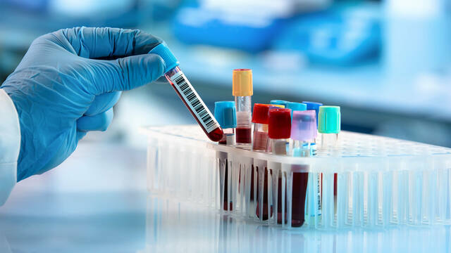 Scientists began developing blood tests for infectious diseases.