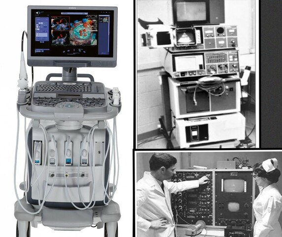 Ultrasound Machines in the 60s and 70s