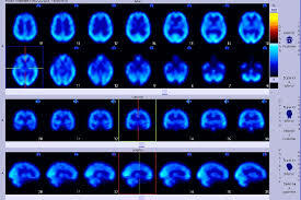 Se descubren medios para el diagnostico de enfermedades