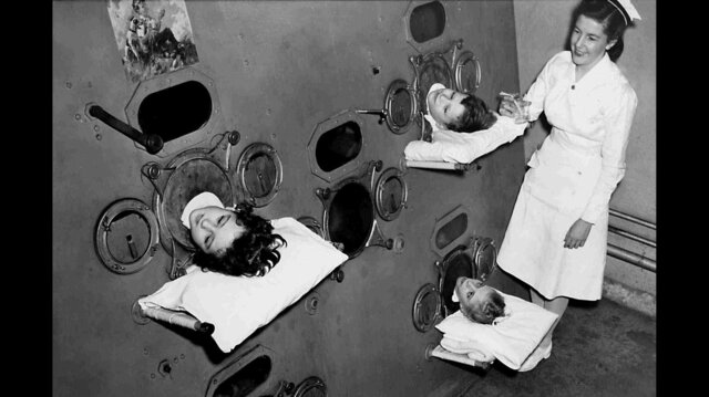 1,000 "iron lung" around the US