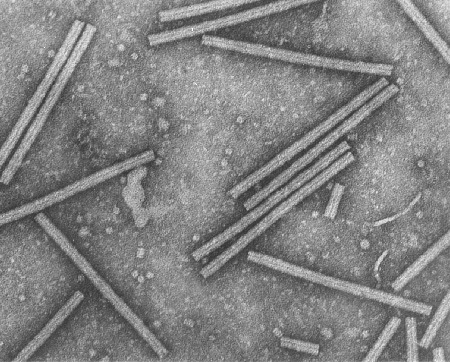 Abandono sobre la investigación del ADN