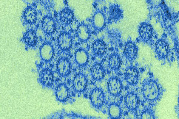 New Strain of Virus Detected
