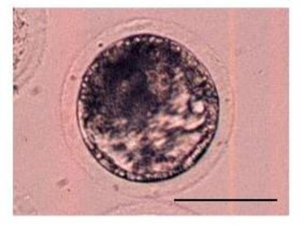 Blastocyst Formation
