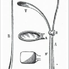 Manuel Vicente García vio que si proyectaba la luz del sol que se reflejaba en un pequeño espejo manual, sobre un espejlllo Introducido en su faringe, podría lograr observar las cuerdas vocales.