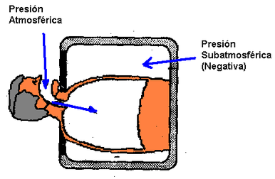 Alfred Jones describe el primer principio donde el aire que se movía dentro y fuera del paciente sea a base de presión negativa