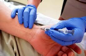 Gases en sangre arterial