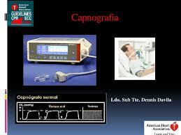 Capnografía