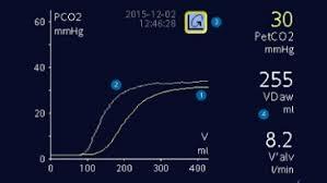 Capnografía  volumétrica