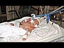 Ventilación mecánica