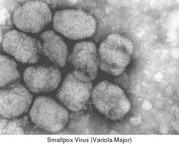 Smallpox