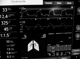 Monitorización ventilatoria.