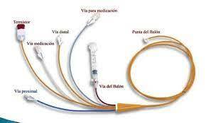 Implementación del Catéter Arterial Pulmonar (CAP) Swan-Ganz