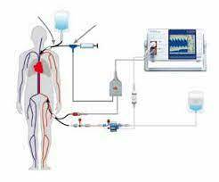 Método de termodilución transpulmonar.