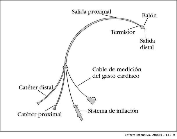 Catéter de Swan-Ganz