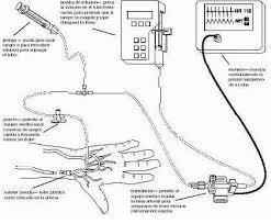 Presión venosa central