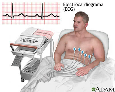 Electrocardiógrafo