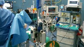 Timeline: Monitorización Invasiva