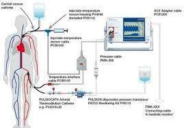 Presión Venosa Central