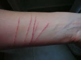 Markel moztu zen besoa