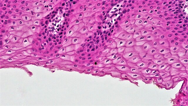The nucleus in epithelial
