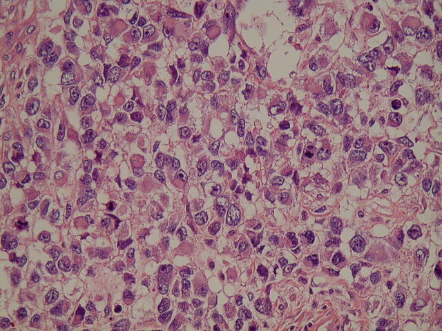 Ergastoplasm was introduced in 1897