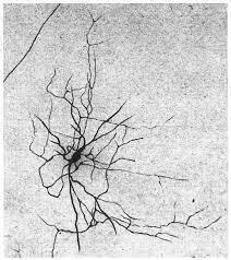 Golgi develops "black reaction"