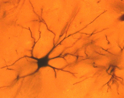 Golgi Develops "Black Reaction"