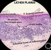 german histologist josepth expands previous views of cells