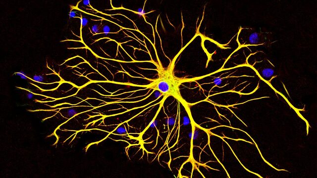 Waldeyer introduces neurons to the cell