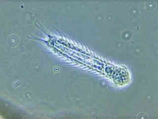 Living organisms seen under a Microscope