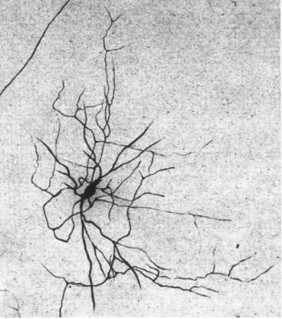 Gologi develops "black reaction"