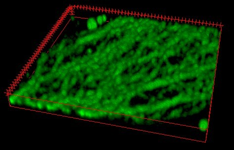 3D Structured illumination microscopy combines a 3-D View, high resolution, multiple colors