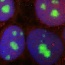 Felice Fontana glimpsed nucleus