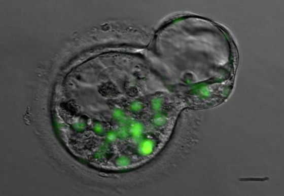 Clonación de la Insulina (Bio Mol)