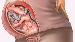 Noveno mes de embarazo