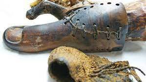 Prótesis de un dedo gordo