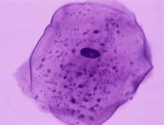 Nucleus in epithelial cells