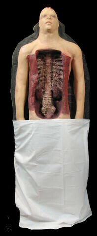 The Autopsy Incident