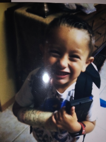 The day I broke my arm