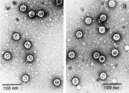 The particles that he saw under his microscope were motile and, assuming that motility equates to life, he went on to conclude, in a letter to the Royal Society, that these particles were indeed living organisms.