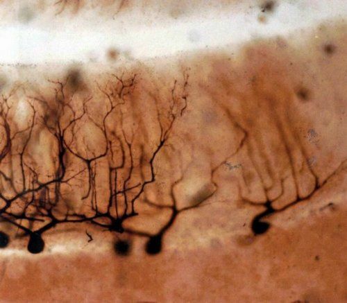 Golgi Developed The Black Reaction