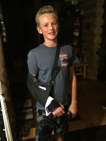 When I broke my cappillaries