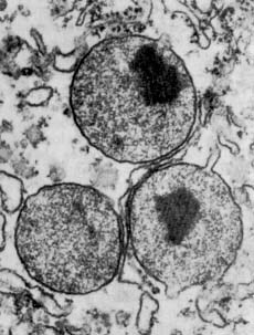 Christian de Duve y los "microcuerpos" (peroxisomas)