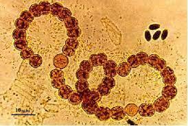 La Teoría Microbiana sin Pasteur y Koch.