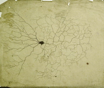 Golgi's "Black Reaction"