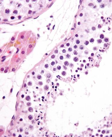 Cada espermatozoide es una célula